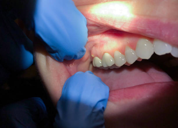 Dentist for Dental Trauma in ID